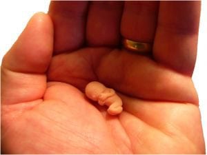 Afbeelding van een hand met een baby na 4 weken zwanger